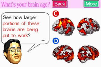 ds brain age